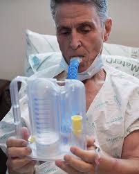 Fisioterapia Respiratória